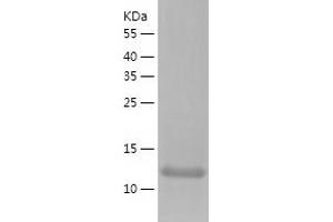 Ubiquitin-Conjugating Enzyme E2A (ube2a) (AA 1-152) protein (His-IF2DI Tag)