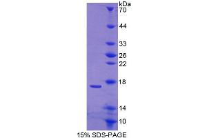SDS-PAGE analysis of Human CABP1 Protein. (CABP1 蛋白)