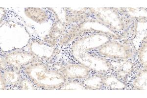 Detection of b2M in Human Kidney Tissue using Monoclonal Antibody to Beta-2-Microglobulin (b2M) (beta-2 Microglobulin 抗体  (AA 22-119))