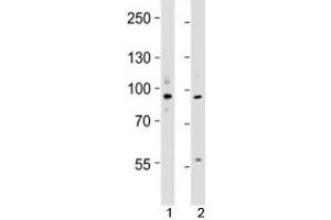 Western blot testing of UHRF1 antibody at 1:4000 dilution; Lane 1: KG-1 lysate, 2: MCF-7 lysate; Predicted molecular weight ~ 88 kDa. (UHRF1 抗体  (N-Term))