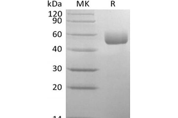 SERPINA1 Protein (His tag)