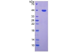 SDS-PAGE of Protein Standard from the Kit  (Highly purified E. (MAG ELISA 试剂盒)