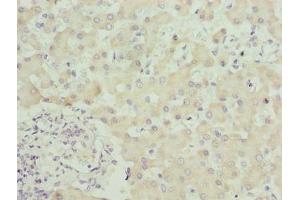 Immunohistochemistry of paraffin-embedded human liver tissue using ABIN7169619 at dilution of 1:100 (SPCS3 抗体  (AA 33-180))