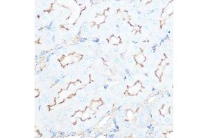 Immunohistochemistry of paraffin-embedded mouse kidney using SSTR5 Rabbit mAb (ABIN7270495) at dilution of 1:100 (40x lens). (SSTR5 抗体)