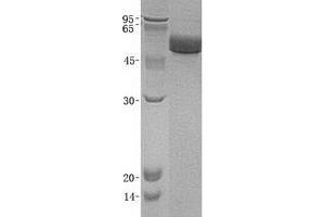 Validation with Western Blot (Fetuin A Protein (His tag))