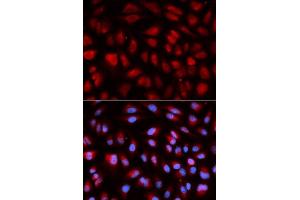 Immunofluorescence analysis of U2OS cells using PLK1 antibody. (PLK1 抗体  (AA 304-603))
