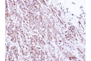 IHC-P Image Immunohistochemical analysis of paraffin-embedded A549 Xenograft, using 20S Proteasome alpha1, antibody at 1:500 dilution. (Proteasome 20S alpha 1 (Center) 抗体)