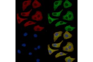 ULK1 Mouse Monoclonal Antibody staining Hela cells by IF/ICC.