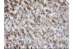 Immunohistochemical staining of paraffin-embedded Human liver tissue using anti-PBX1 mouse monoclonal antibody. (PBX1 抗体)