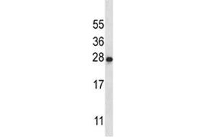 IL-22 antibody western blot analysis in K562 lysate (IL-22 抗体  (AA 44-73))