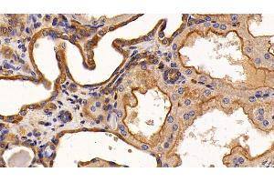 Detection of EGFR in Human Kidney Tissue using Monoclonal Antibody to Epidermal Growth Factor Receptor (EGFR)