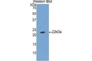 Detection of Recombinant IGFBP1, Porcine using Polyclonal Antibody to Insulin Like Growth Factor Binding Protein 1 (IGFBP1) (IGFBPI 抗体  (AA 112-262))