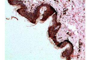 Immunohistochemical analysis of paraffin-embedded human-skin, antibody was diluted at 1:200 (Desmoglein 1 抗体  (AA 30-90))
