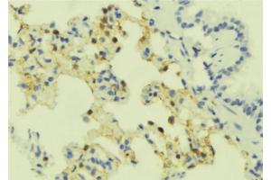 ABIN6273909 at 1/100 staining Mouse lung tissue by IHC-P. (SSTR4 抗体  (C-Term))