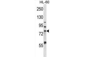Western Blotting (WB) image for anti-Matrix Metallopeptidase 15 (Membrane-inserted) (MMP15) antibody (ABIN2997513) (MMP15 抗体)