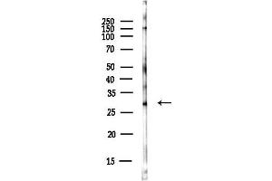 anti-Meteorin, Glial Cell Differentiation Regulator (METRN) antibody