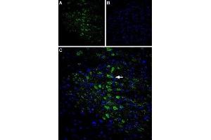 Expression of CaVγ6 (CACNG6) in rat brain - Immunohistochemical staining of rat cingulate cortex using Anti-CACNG6 (extracellular) Antibody (ABIN7042994, ABIN7044055 and ABIN7044056), (1:400). (CACNG6 抗体  (1st Extracellular Loop))