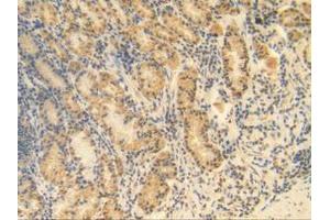 IHC-P analysis of Human Stomach Tissue, with DAB staining. (MGP 抗体  (AA 1-103))