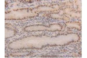 IHC-P analysis of Human Stomach Tissue, with DAB staining. (PCNA 抗体  (AA 6-261))