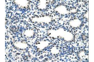 Image no. 1 for anti-protein ariadne-2 homolog (ARIH2) (N-Term) antibody (ABIN203288) (ARIH2 抗体  (N-Term))