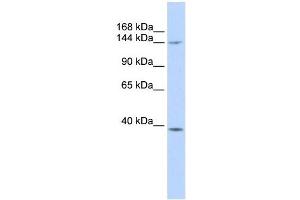 SMC4 antibody used at 1 ug/ml to detect target protein. (SMC4 抗体  (Middle Region))