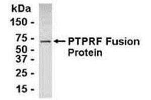 Western Blotting (WB) image for anti-Protein Tyrosine Phosphatase Receptor Type F (PTPRF) (AA 1151-1225) antibody (ABIN2467995)