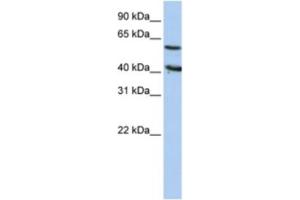 Western Blotting (WB) image for anti-5'-Nucleotidase, Cytosolic III (NT5C3) antibody (ABIN2460388) (NT5C3 抗体)