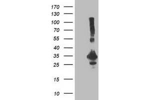 Western Blotting (WB) image for anti-Phenylethanolamine N-Methyltransferase (PNMT) antibody (ABIN1500308) (PNMT 抗体)