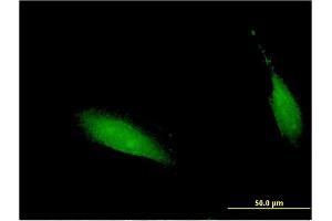Immunofluorescence of monoclonal antibody to CENPV on HeLa cell. (CENPV 抗体  (AA 173-272))