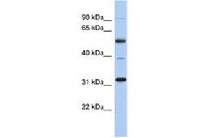 Image no. 1 for anti-TBC1 Domain Family, Member 26 (TBC1D26) (AA 107-156) antibody (ABIN6743882) (TBC1D26 抗体  (AA 107-156))