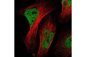 Immunofluorescent staining of U-2 OS with NACC1 polyclonal antibody  (Green) shows positivity in nucleus but excluded from the nucleoli. (NAC1 抗体)