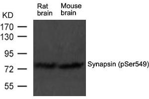 Western blot analysis of extract from rat brain and mouse brain tissue using Synapsin(phospho-Ser549) Antibody using (SYN1 抗体  (pSer549))