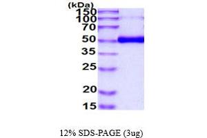 SDS-PAGE (SDS) image for Tumor Necrosis Factor Receptor Superfamily, Member 11b (TNFRSF11B) (AA 22-401) protein (His tag) (ABIN7529432) (Osteoprotegerin Protein (AA 22-401) (His tag))