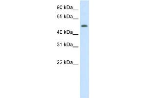 WB Suggested Anti-DIDO1 Antibody Titration:  0. (DIDO1 抗体  (N-Term))