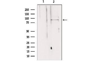 Western blot analysis of extracts from 293, using AGGF1 antibody. (AGGF1 抗体  (Internal Region))