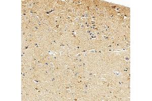 IHC analysis of UBE3A using anti-UBE3A antibody (ABIN7599562).