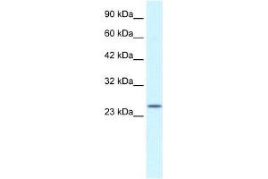 Human Jurkat; WB Suggested Anti-ZA20D3 Antibody Titration: 2. (ZFAND6 抗体  (Middle Region))