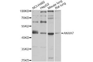 Western blot analysis of extracts of various cell lines, using ANXA7 antibody (ABIN5971923) at 1/1000 dilution. (Annexin VII 抗体)