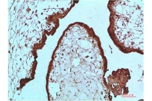 Immunohistochemical analysis of paraffin-embedded Human Placenta Tissue using HP-1 α Mouse mAb diluted at 1:200 (CBX5 抗体)