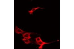ABIN6267547 staining HeLa by IF/ICC. (VASP 抗体  (pSer239))