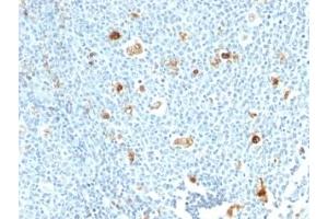 Formalin-fixed, paraffin-embedded human tonsil stained with Calprotectin antibody (CPT/1028) (Calprotectin 抗体)