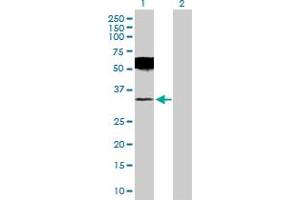 Western Blot analysis of UCHL1 expression in transfected 293T cell line by UCHL1 MaxPab polyclonal antibody. (UCHL1 抗体  (AA 1-223))