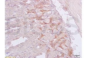 Formalin-fixed and paraffin embedded mouse stomach labeled with Anti-SGCB/SGC Polyclonal Antibody, Unconjugated (ABIN738051) at 1:200 followed by conjugation to the secondary antibody and DAB staining. (SGCB 抗体  (AA 165-260))