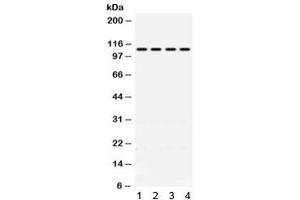 Western blot testing of 1) rat kidney, 2) mouse kidney, 3) human HeLa and 4) human A431 lysate with MR antibody. (NR3C2 抗体)