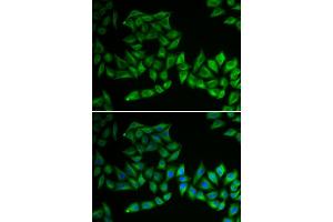 Immunofluorescence analysis of U2OS cell using TPMT antibody. (TPMT 抗体)