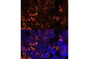 Immunofluorescence analysis of rat bone marrow cells using GPR55 antibody (ABIN6130402, ABIN6141351, ABIN6141352 and ABIN6216688) at dilution of 1:100.