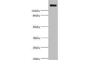 Western blot All lanes: CARD11 antibody at 4 μg/mL + K562 whole cell lysate Secondary Goat polyclonal to rabbit IgG at 1/10000 dilution Predicted band size: 133 kDa Observed band size: 133 kDa (CARD11 抗体  (AA 985-1154))