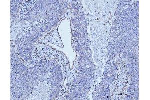 IHC analysis of CD93 using anti-CD93 antibody (ABIN7602865).