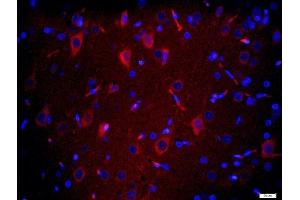 Paraformaldehyde-fixed, paraffin embedded rat brain tissue, Antigen retrieval by boiling in sodium citrate buffer(pH6) for 15min, Block endogenous peroxidase by 3% hydrogen peroxide for 20 minutes, Blocking buffer (normal goat serum) at 37°C for 30min, Antibody incubation with TMEM158 Polyclonal Antibody, Unconjugated  at 1:200 overnight at 4°C, followed by a conjugated secondary and DAPI staining (TMEM158 抗体  (AA 188-260))