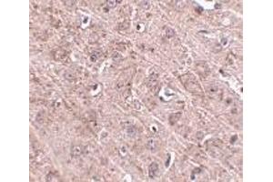 Immunohistochemistry of Gle1 in mouse brain tissue with Gle1 antibody at 2. (GLE1 抗体  (Center))